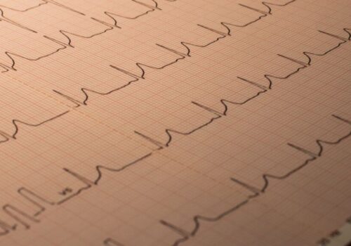Sensitivity and HRV